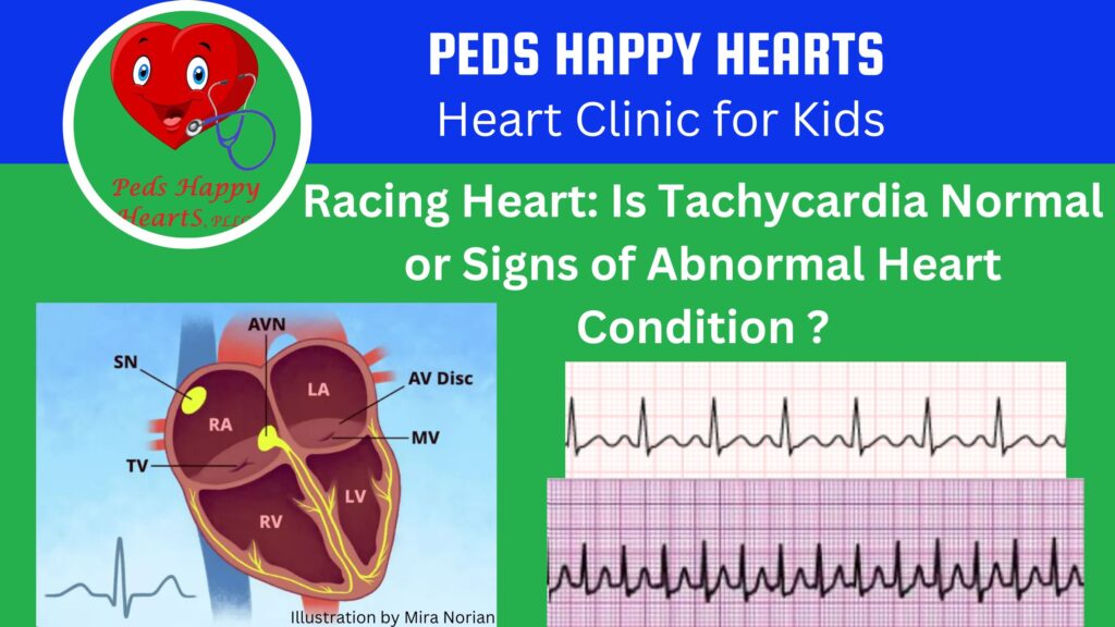 Tachycardia: Normal or abnormal?