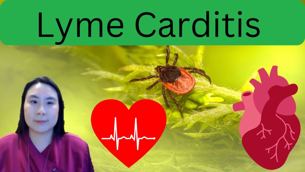 Lyme Carditis
